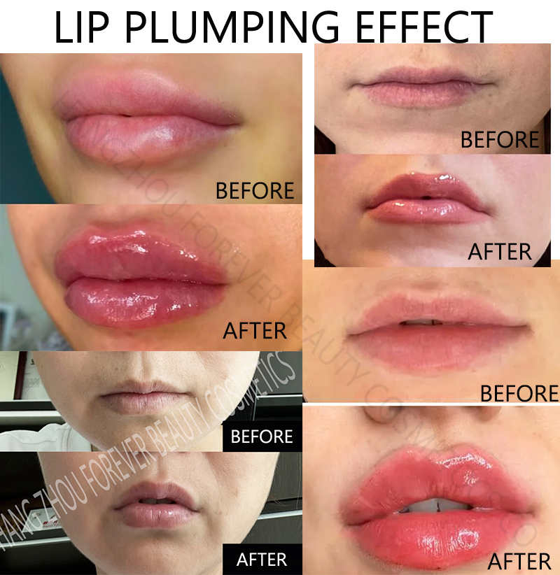 Hyaluronic Acid Collagen UV Protection Supper Volumizing Lip Plumper Gloss Lip Filler with White Label