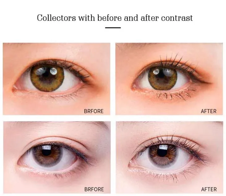 Before and After