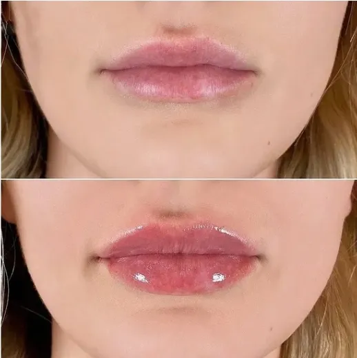Private Label Vegan Hyaluronic Acid Iridescent Finish Long-Lasting Strong Sting Lip Plumper Gloss with ODM Service