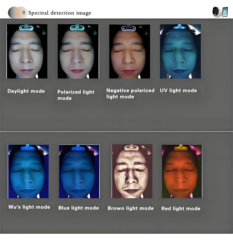 3D Skin Analyzer