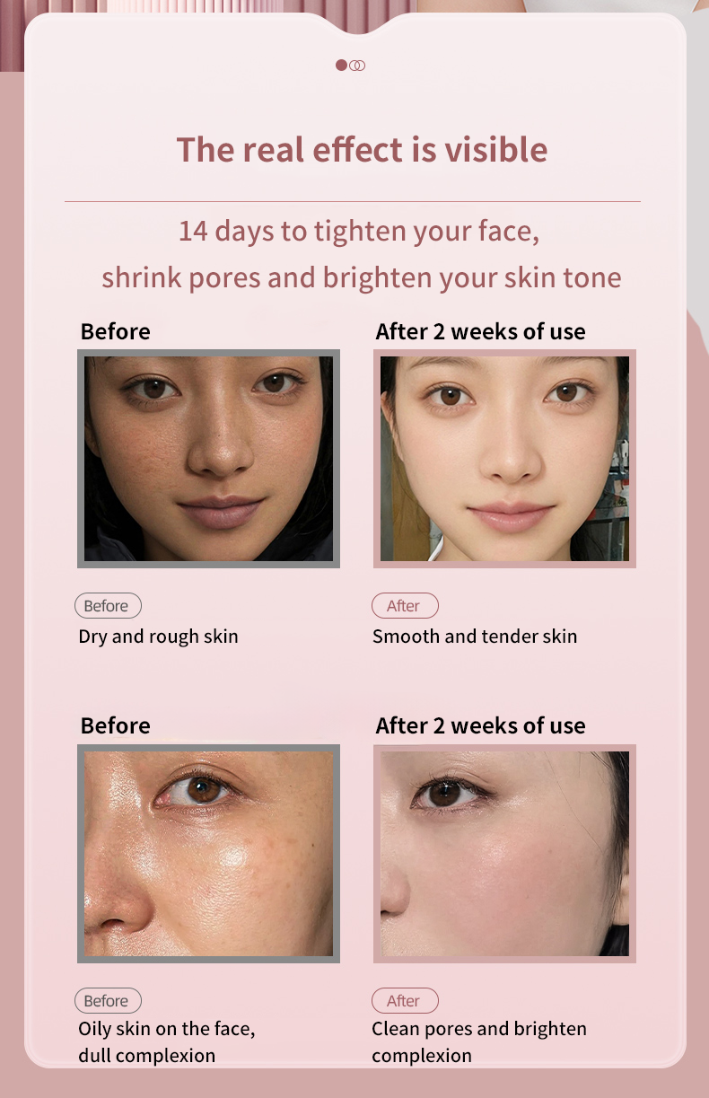 Electric Portable Facial Steamer - Operation