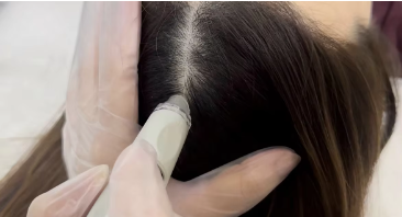 Deep Scalp Cleansing