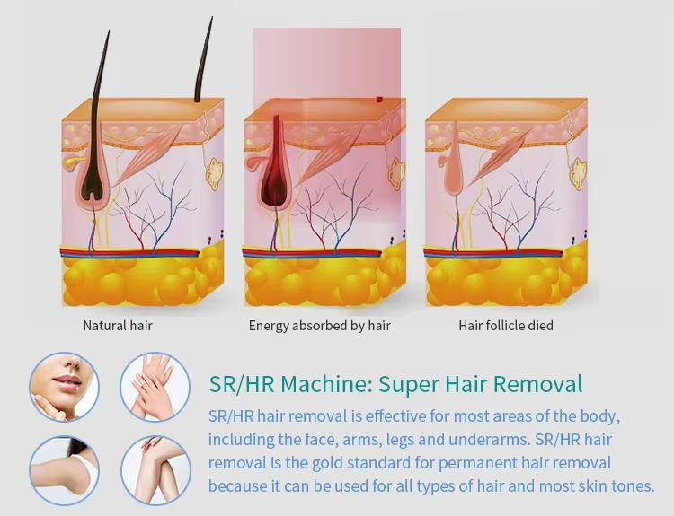 Portable IPL Facial Beauty Machine IPL Hair Removal Super Acne Removal Blood Vessels Removal Opt Laser Hair Removal Machine