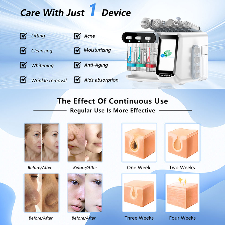 W05X 4.0 8 in 1 Small Bubble Hydro Skin Management Machine Water Oxygen Peeling Deep Cleansing Ultrasonic Beauty Device