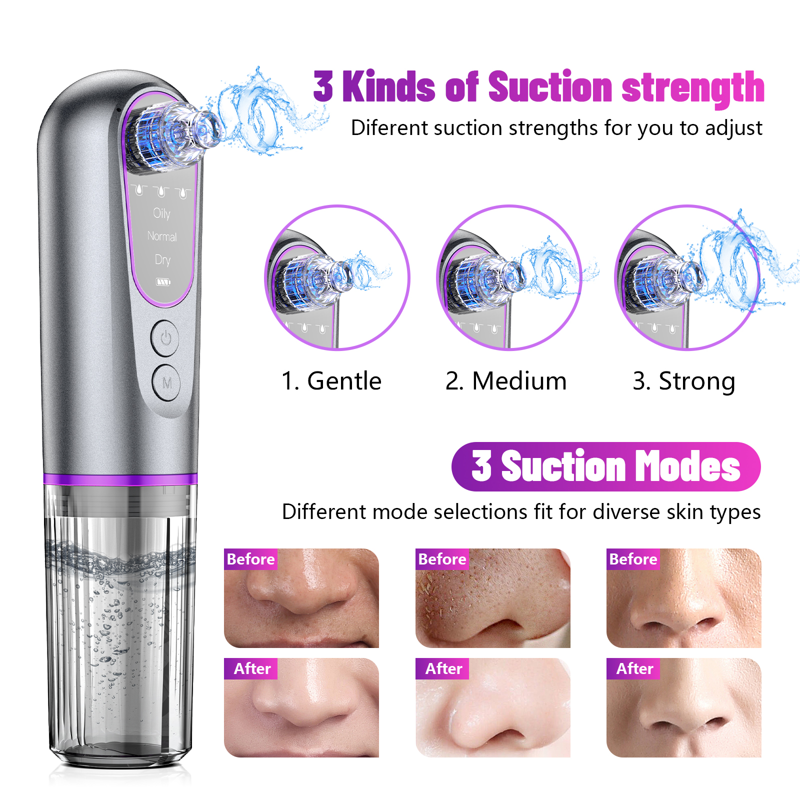 Pore Vacuum Blackhead Remover Multi-functional Facial Smart Handheld Suction Machine Electric Blackhead Remover Vacuum