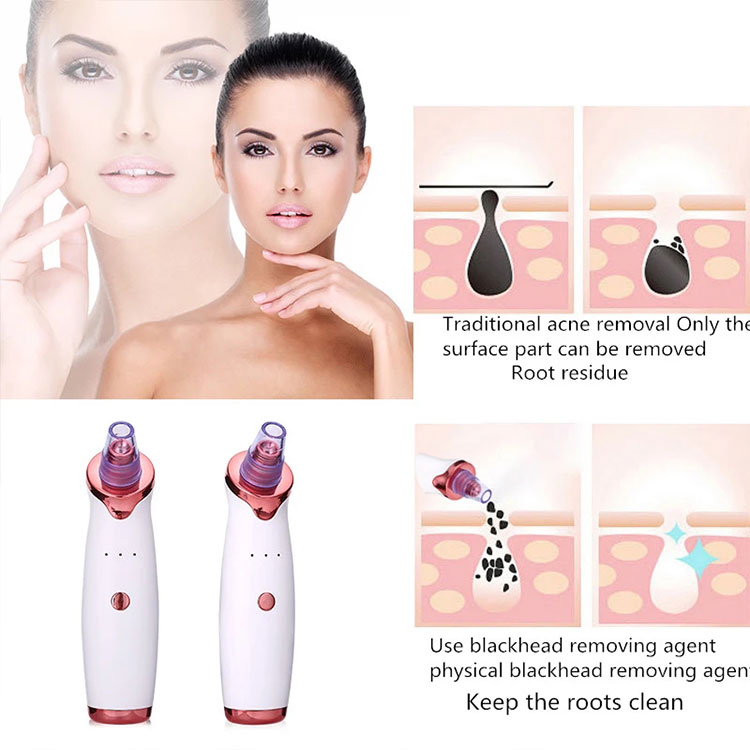 Professional Portable Electric Face Vacuum Suction Blackhead Cleaner Tool Rechargeable Vacuum Blackhead Remover Tools