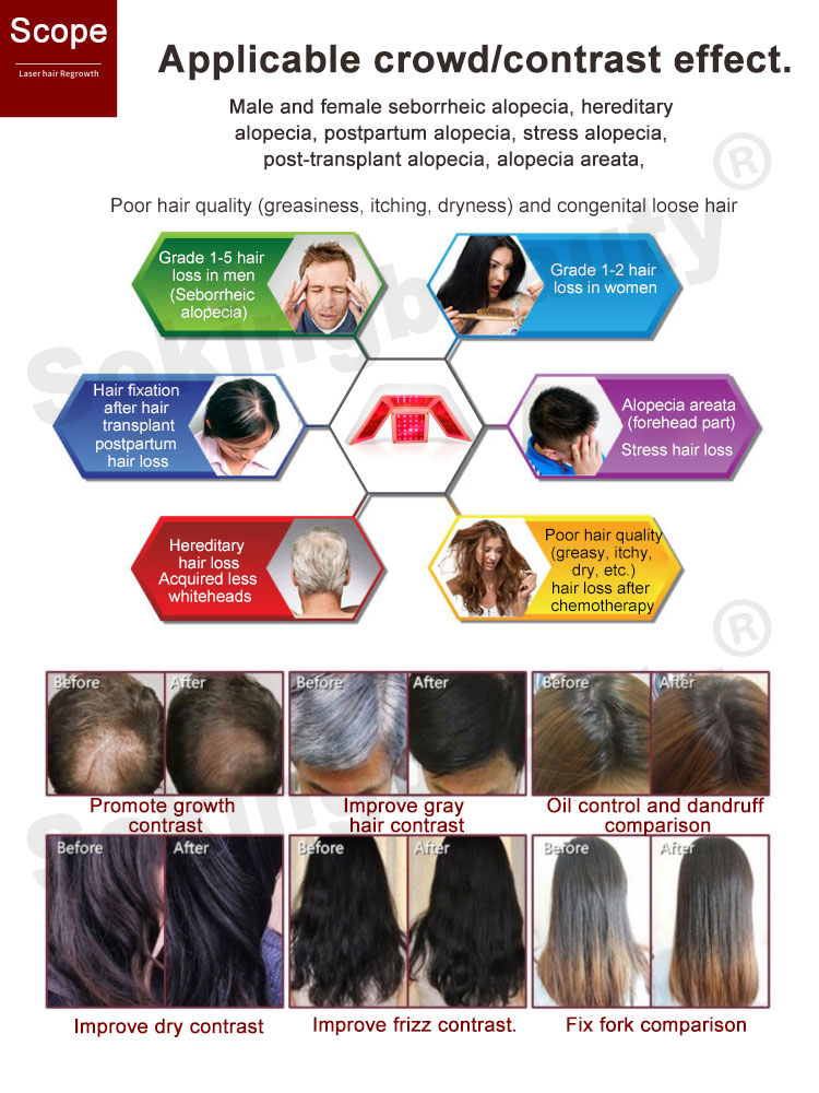 Hair Regrowth Treatment Scalp Analysis Machine Image 6