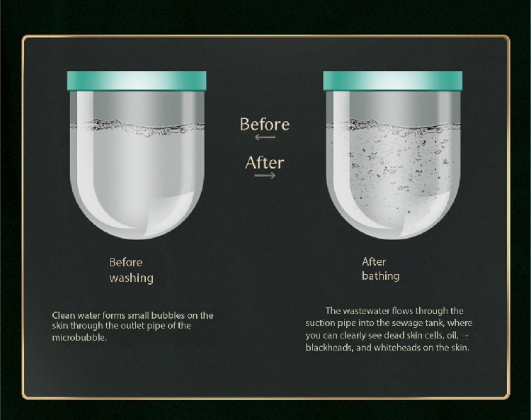 Professional CE Certified Hydra Beauty Skin Detox Facial Machine Treatments Personalized Hydro Dermabrasion Equipment