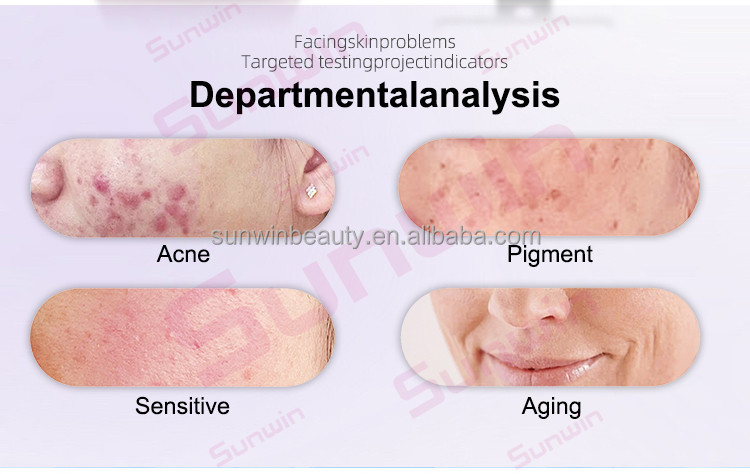 Skin Diagnosis Interface