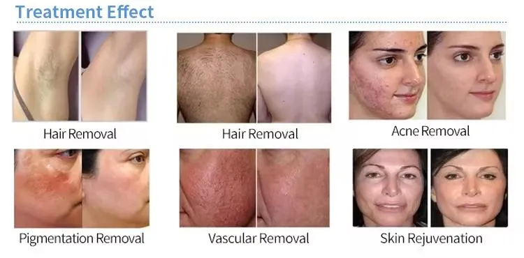 Skin Treatment Results