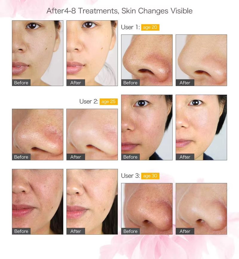 Auro 8 in 1 Facial Machine 8