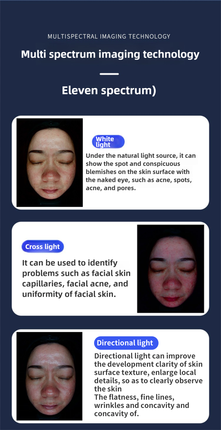 Skin Analyzer Detail 4