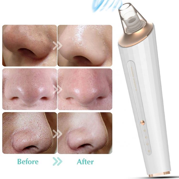 Blackhead Remover Suction Facial Vacuum Beauty Machine Acne Treatment Waterproof Pore Cleanser Set