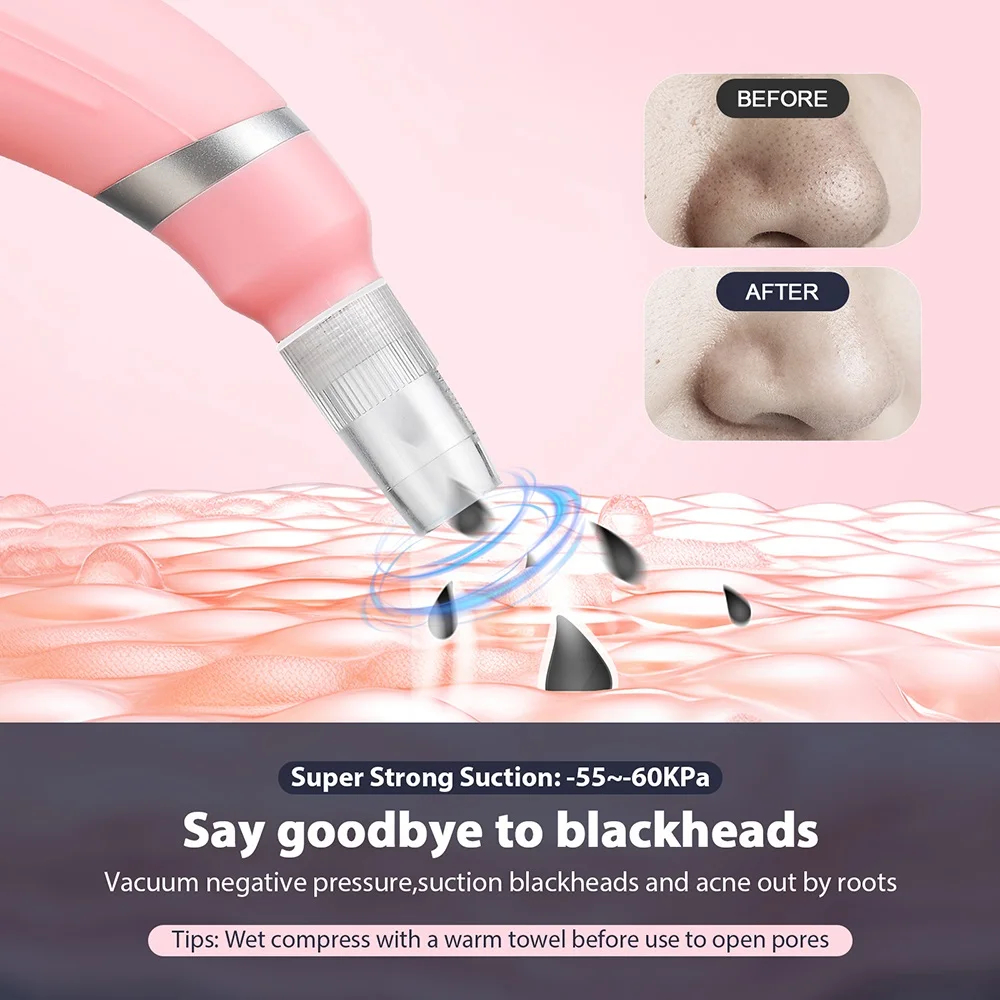 K Handheld 2 in 1 Wrinkle Removal Microdermabrasion Machine for Blackhead Removal Deep Cleansing Machine Dead Skin Removal
