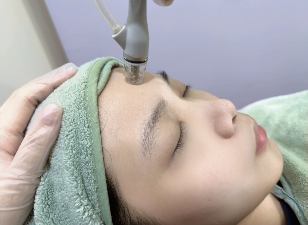 Crystal Dermabrasion Handle