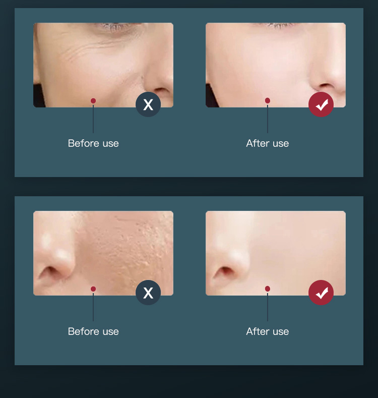 Anti Aging Beauty Device