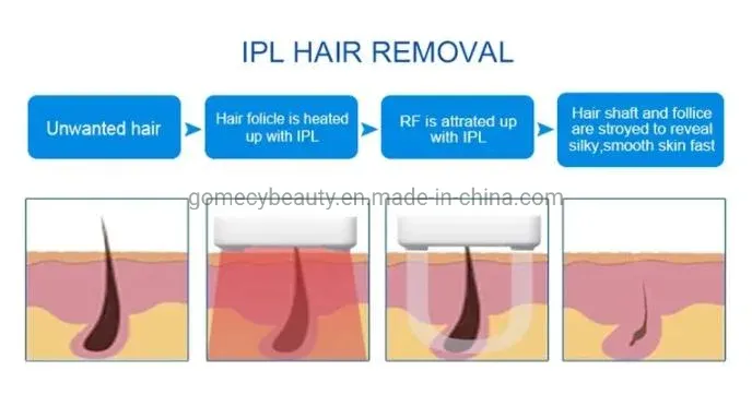 Opt IPL + Elight + RF + ND YAG Laser 4 in 1 Multifunction Facial Treatment