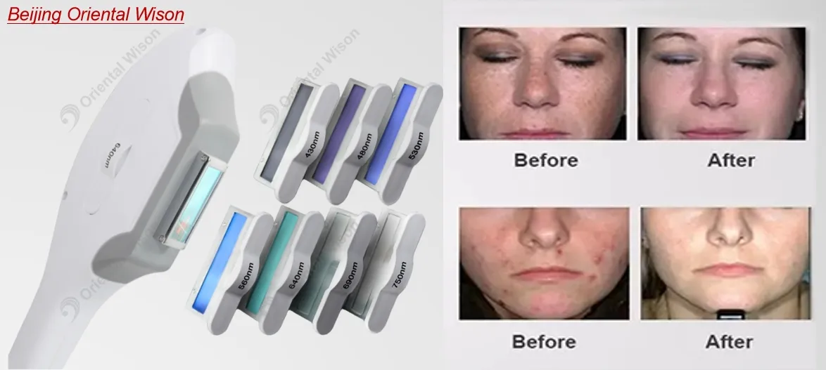 Diode Laser Hair Removal IPL Cell Light Skin Rejuvenation YAG Laser Tattoo Ink Pigment Removal RF Facial Lifting Body Slimming Skin Beauty Equipment