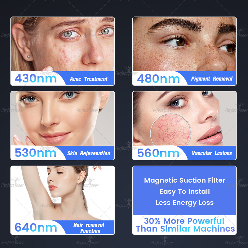 Laser IPL Machine for Facial Hair Removal Photofacial Beauty