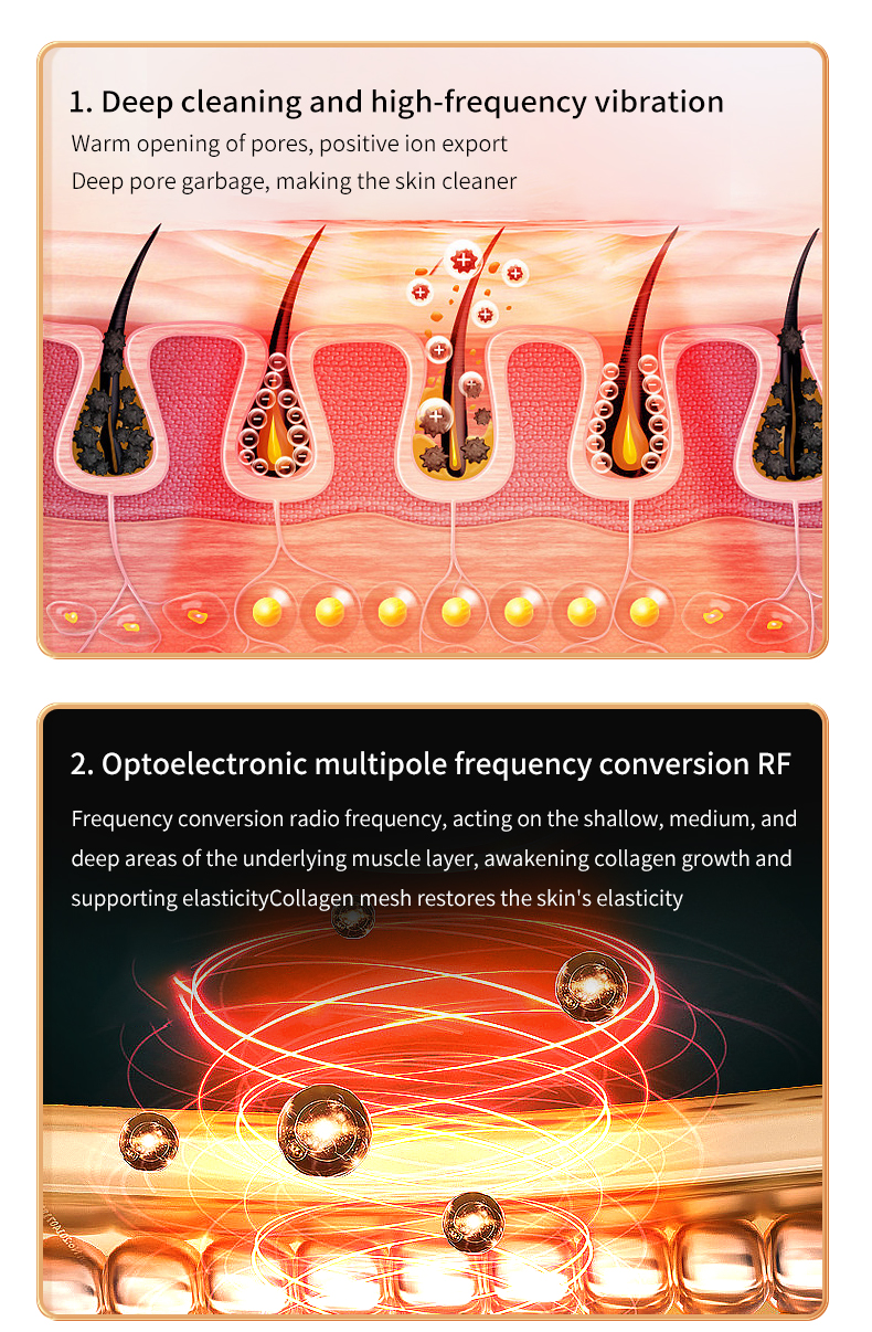 RF Beauty Device Feature 2