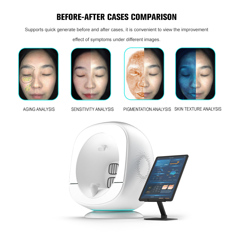 30+ Detection Dimensions Skin Analyzer with Android System Scientific Aging Quantification Via AI Algorithm for Salon Use