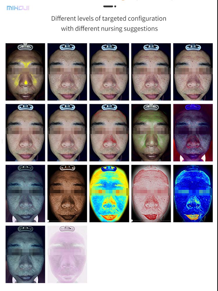 Skin Analyzer Detail 8
