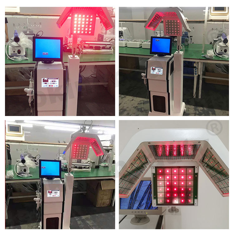 Hair Regrowth Treatment Scalp Analysis Machine Image 3