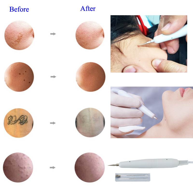 Auro 8 in 1 Cautery Ultrasonido Skin Tightening Vacuum Spray Face Cleaning Brush Galvanic Facial Machine
