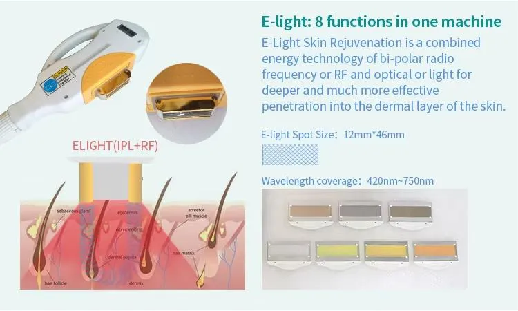 Energy Delivery Mechanism