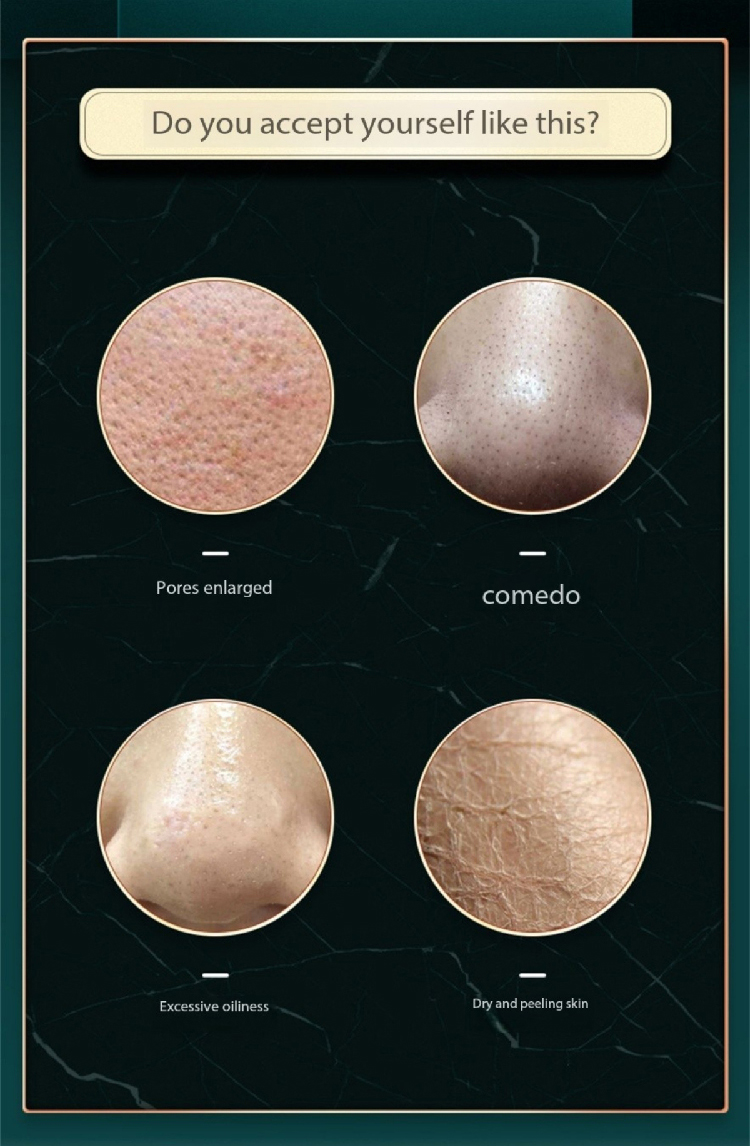 Hydra Diamond Microdermabrasion Machine feature 2