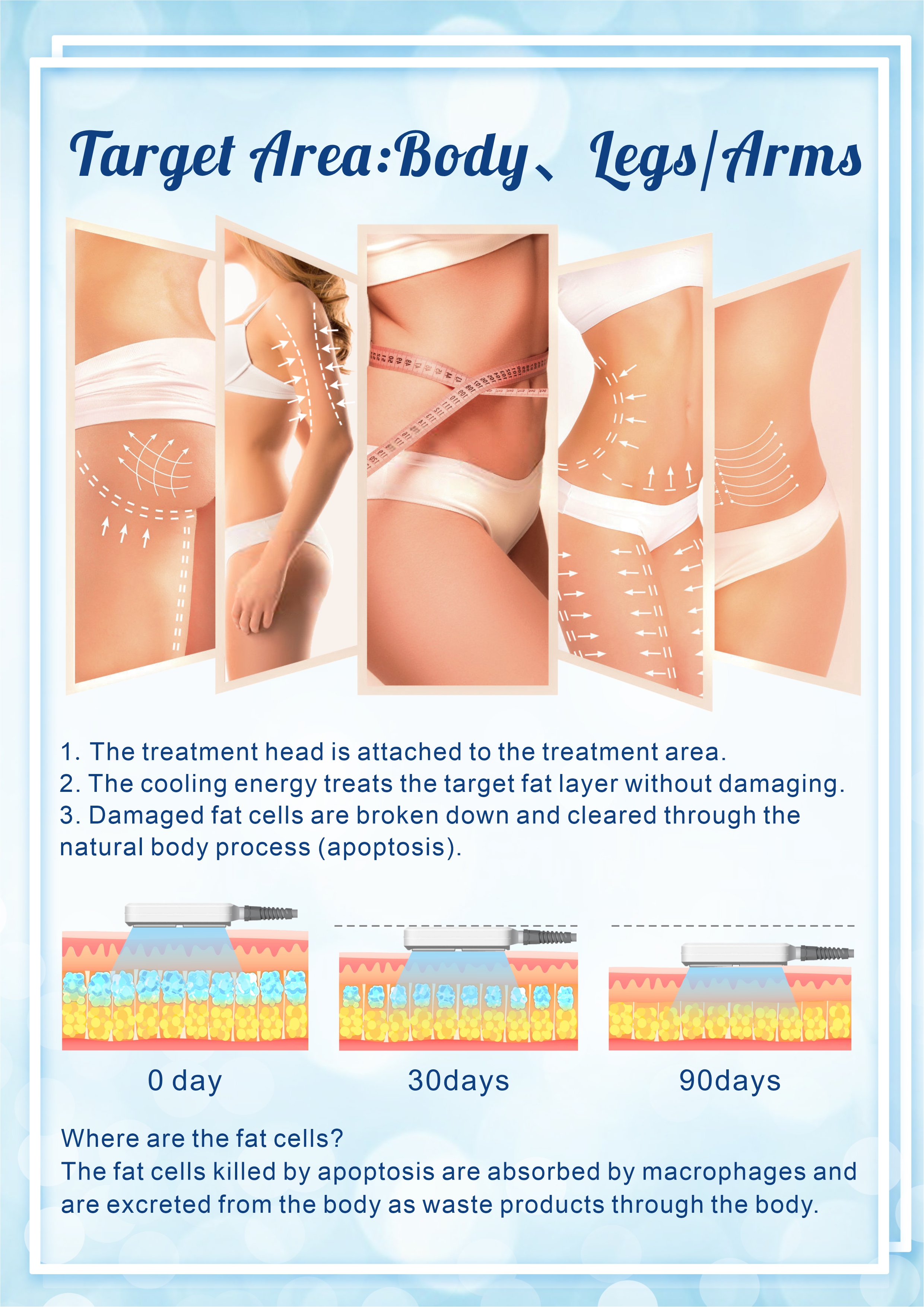 Before and After Results