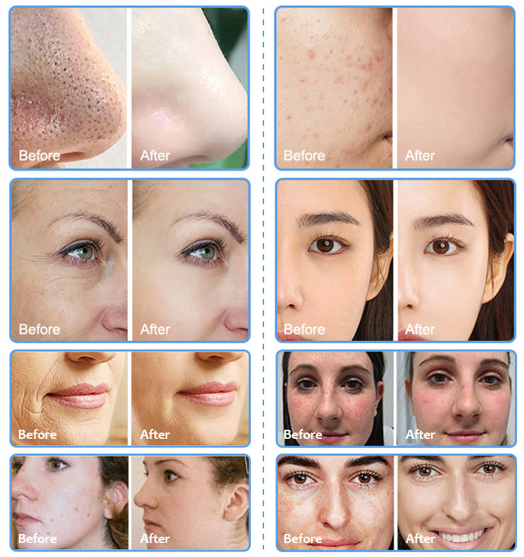Before and after treatment effects