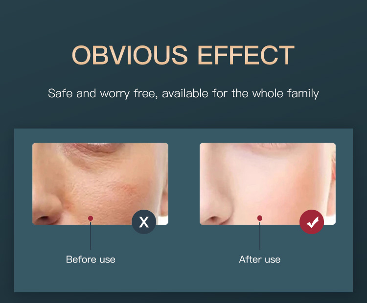 Wrinkle Removal LED Mask
