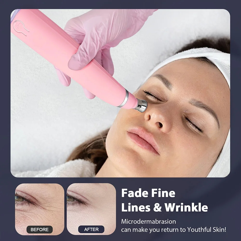 K Handheld 2 in 1 Wrinkle Removal Microdermabrasion Machine for Blackhead Removal Deep Cleansing Machine Dead Skin Removal