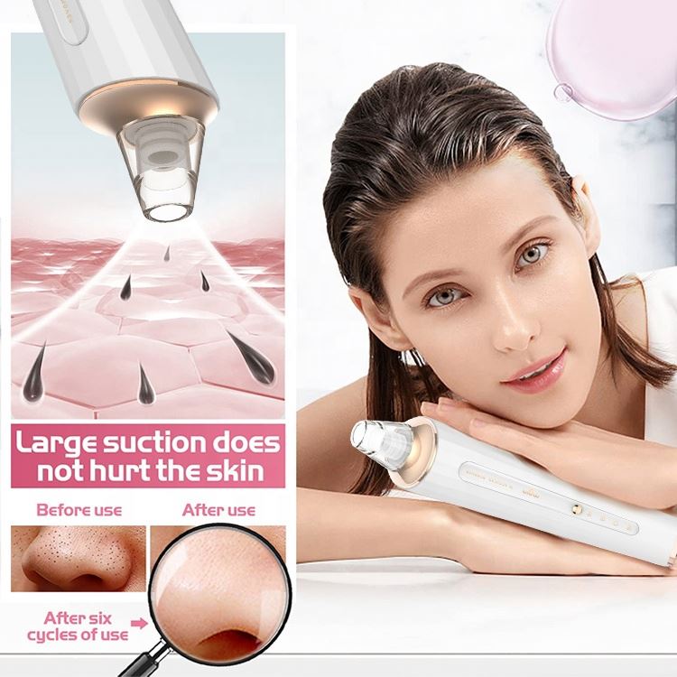 Blackhead Remover Suction Facial Vacuum Beauty Machine Acne Treatment Waterproof Pore Cleanser Set
