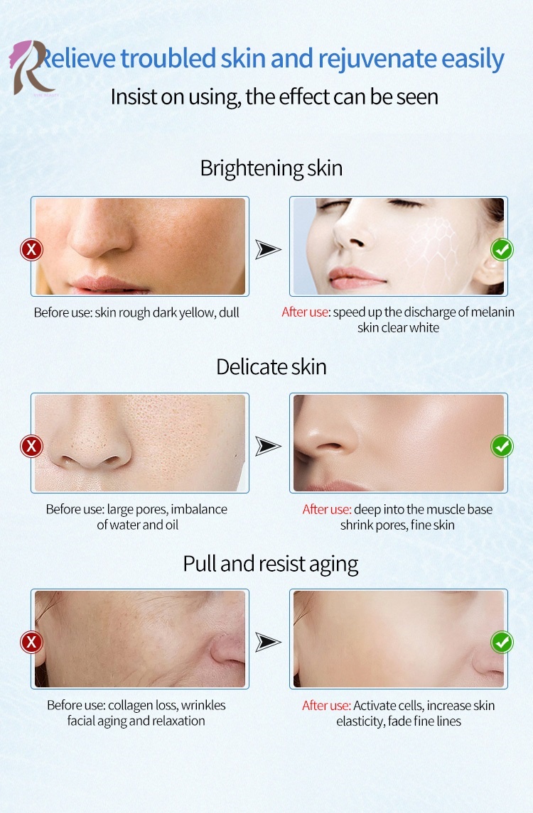 Hot Cold Hammer Skin Cool Lifting Cryotherapy Facial Equipment Fast Shipping US Plug ABS Material for Face