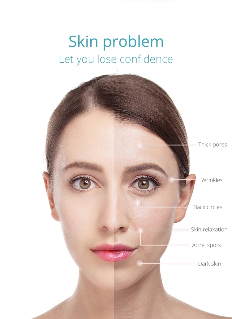 Dermabrasion Beauty Machine 9