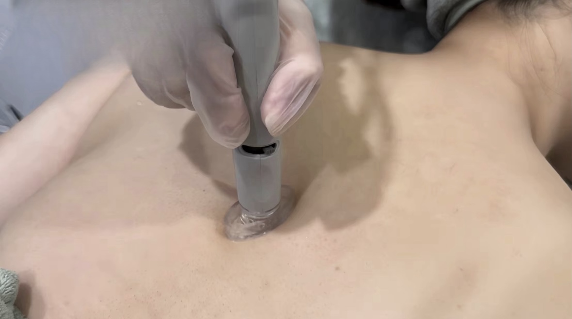 Deep back cleansing