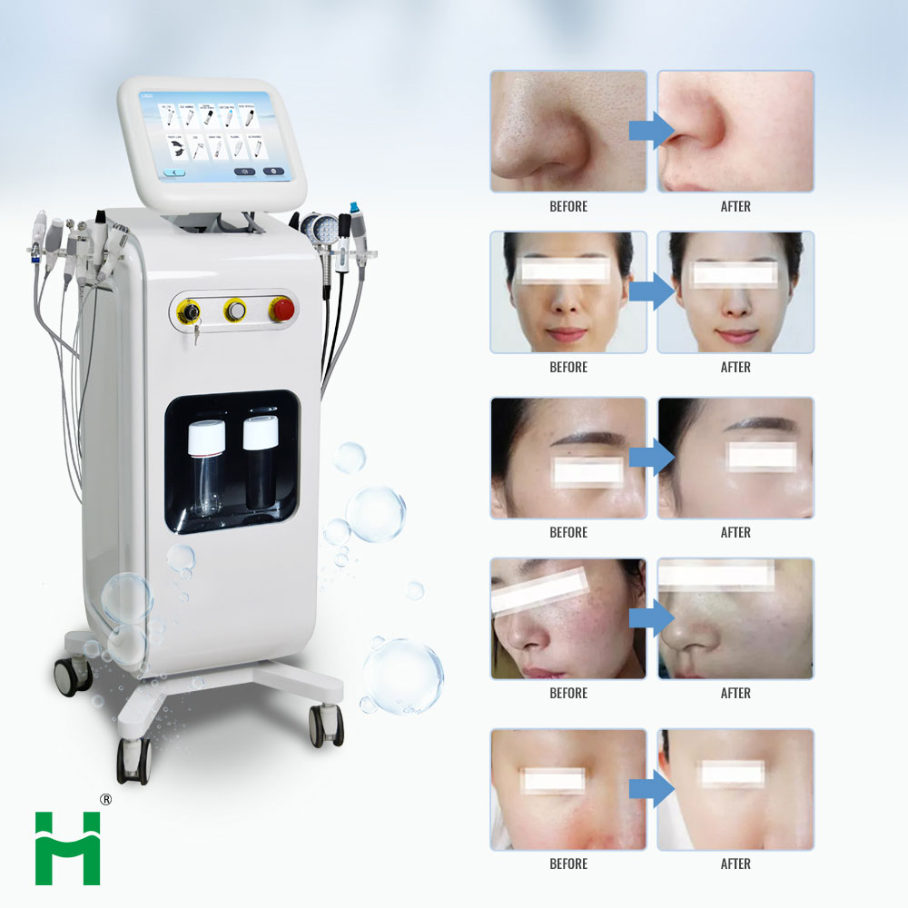 Professional Spa Ultrasonic Skin Rejuvenation Hydro Aqua Facial System with Dermabrasion Microdermabrasion and Jet Peel Therapy