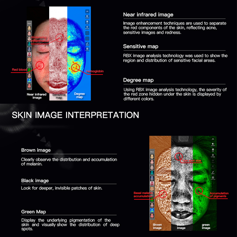 High Quality Portable Facial Analysis Skin Monitor Analyzer Tester 3D Digital Skin Analyzer Machine