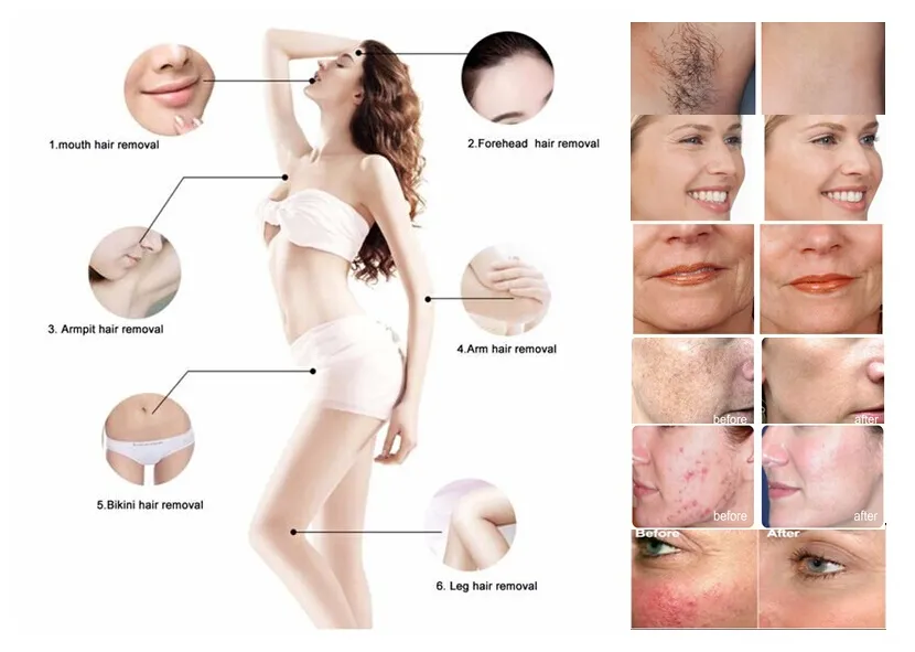 Portable Elight Facial Beauty Machine IPL RF Multifunction System Elight Beauty Equipment Portable Hair Removal IPL RF Equipment