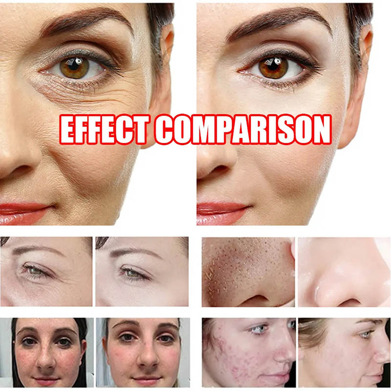 17 in 1 Hydra Skin Purifying Revitalizing Cleansing Hydro Beauty Professional Facial Machine