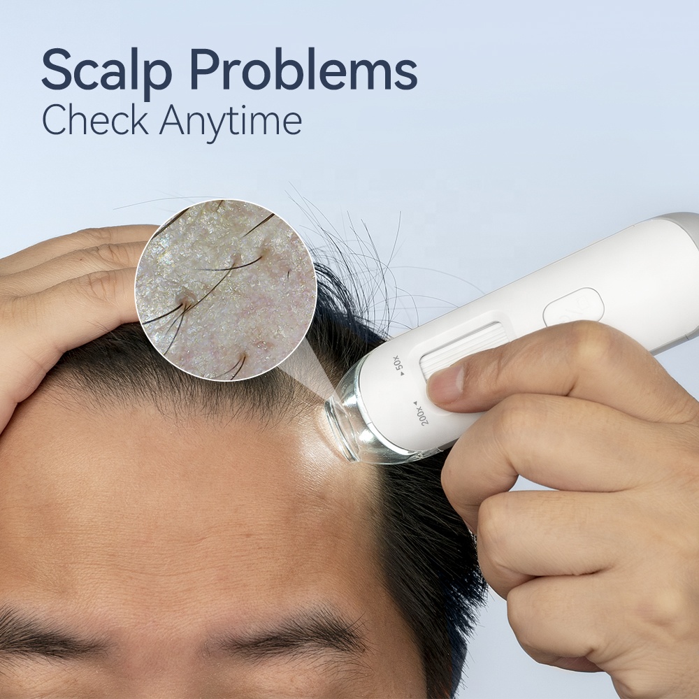 Kimairay Hair Growth Scalp Massage Therapy Machine Hair Skin Analyzer Hair Follicle Scanner Device