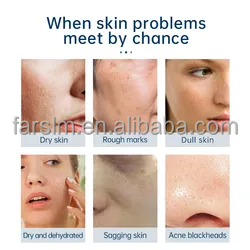 FARSLIM 6 in 1 Oxygen Jet Peel Skin Whitening Anti-Aging Skin Cleaning Acne Treatment Oxygen Hydradermabrasion Facial Machine