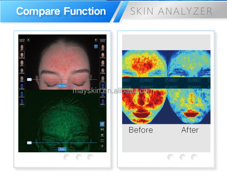 High End Meicet 3D Advanced AI Facial Skin Scanner Skin Analysis Device for Beauty Center/ Beauty Spa / Clinic