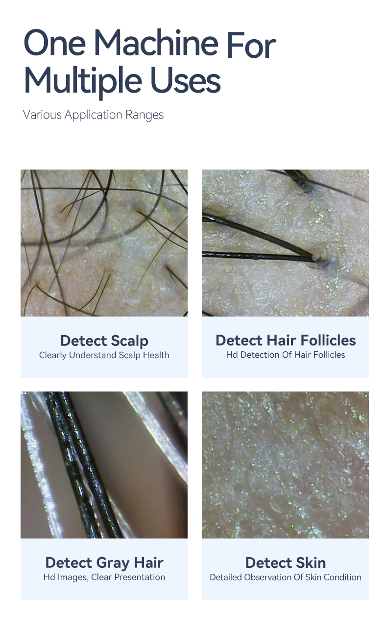 RF beauty instrument details