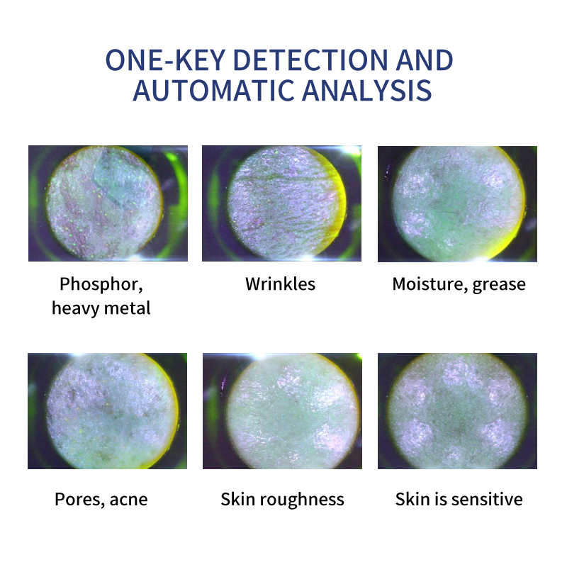 Portable Desktop CryoHydro Oxygen Smart Ice Blue Machine Microdermabrasion Facial Cleansing Skin Analysis Beauty Device