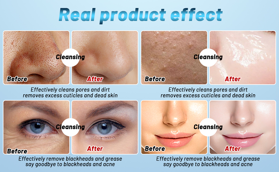 Beauty Device Feature 2