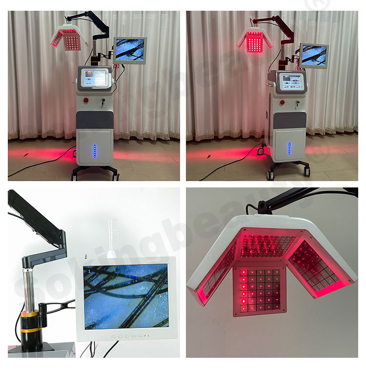 Hair Regrowth Treatment Scalp Analysis Machine Image 4