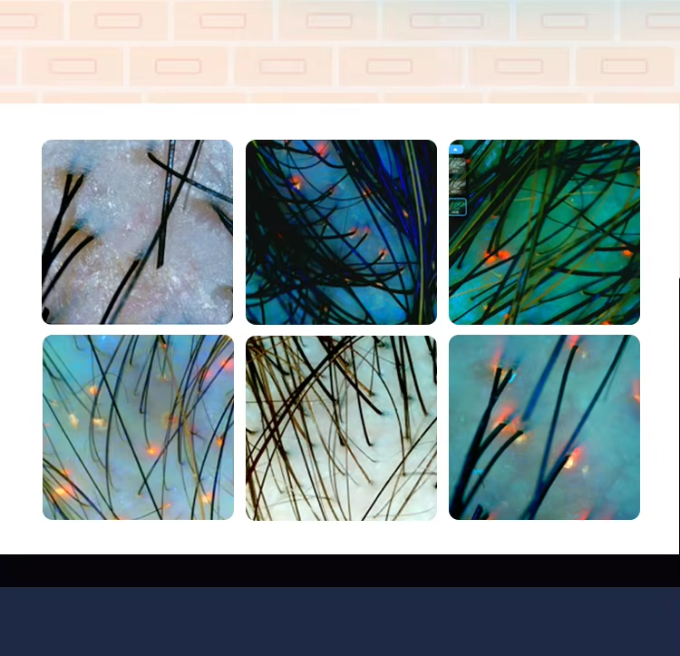 Skin analysis report screen 4